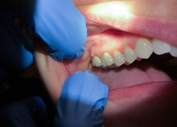 Best Weekend Emergency Dentist in Titusville, PA